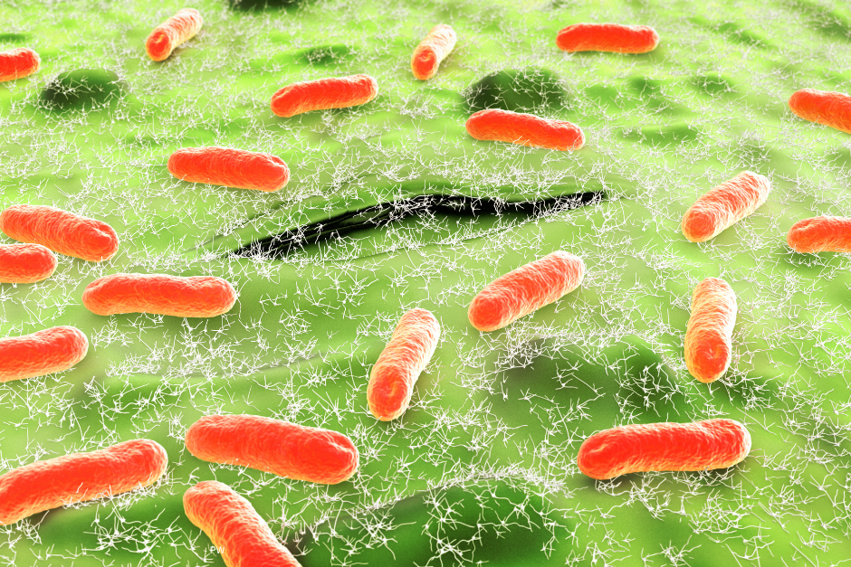 E. coli bacteria contamination in drinking water