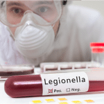 Legionella in Water Systems: Comparison
